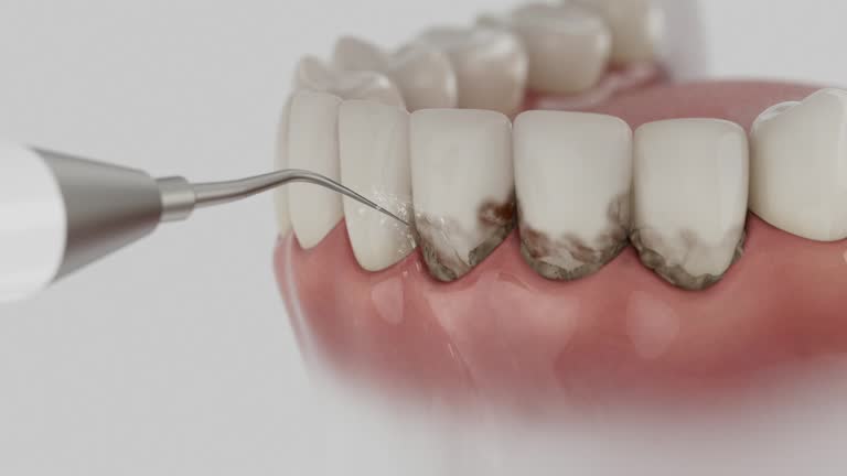 Trusted Teeth Cleaning And Checkup service in Woodinville, WA - Dentist Open Now